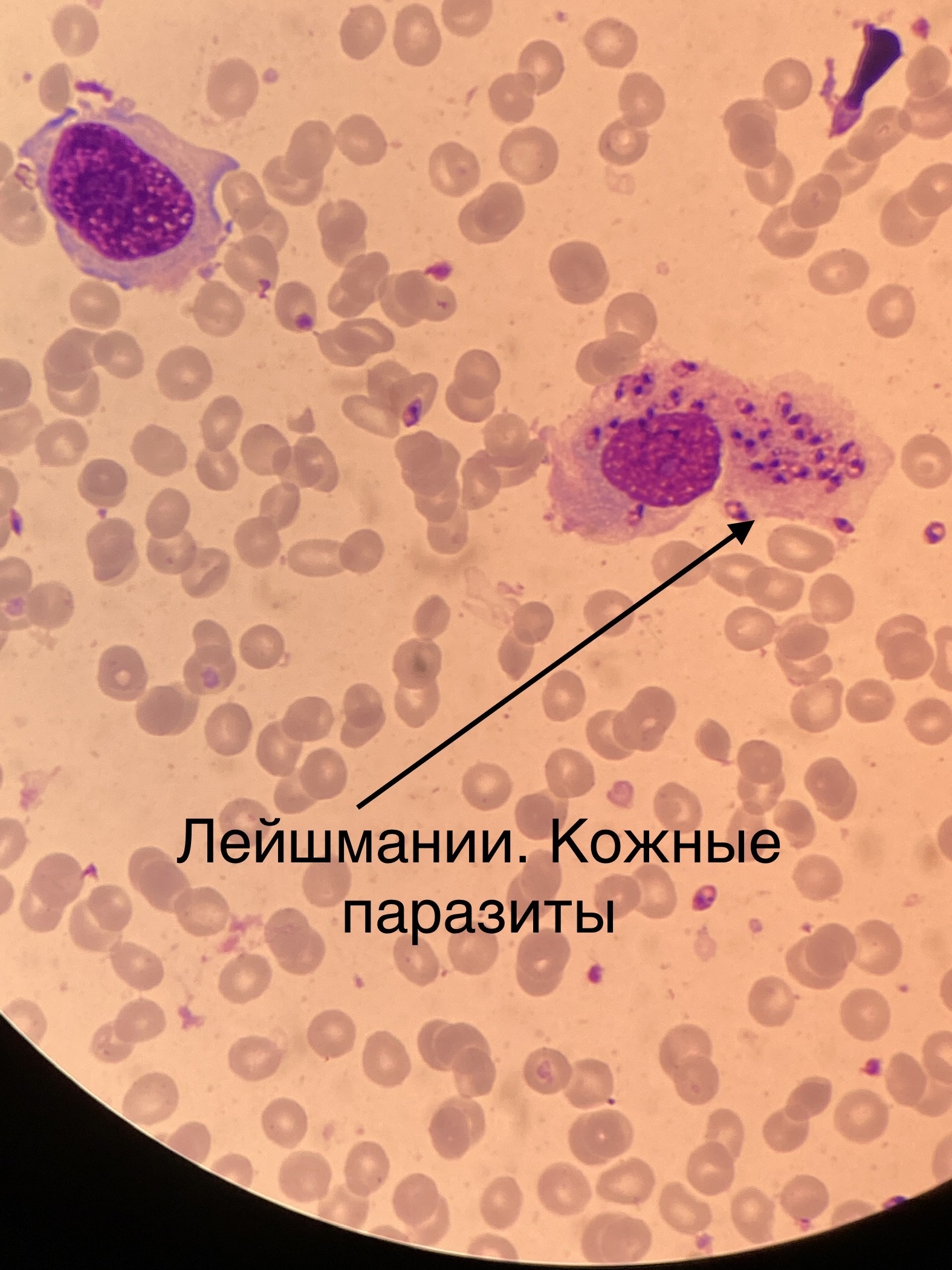 Лейшмания доновани