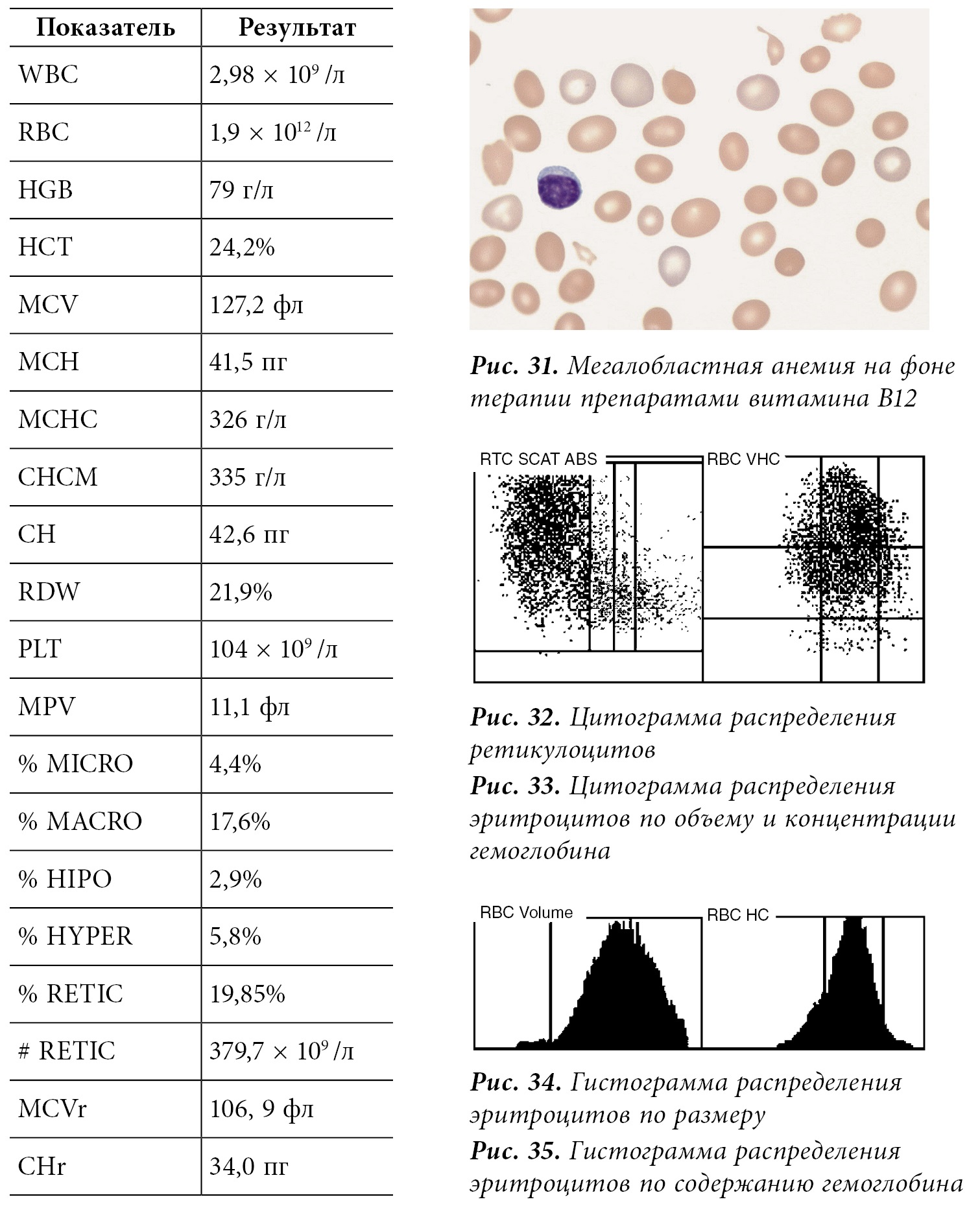 Результаты 1/4. Результат 298. Тироксин свободный ft4 результат 12. Результат 298. Макропролактин норма у женщин.