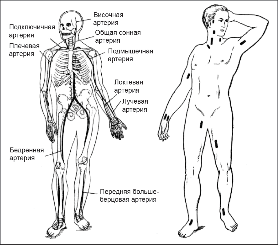 Картинка точки прижатия артерий